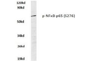 Image no. 1 for anti-Nuclear Factor-kB p65 (NFkBP65) (pSer276) antibody (ABIN318082) (NF-kB p65 anticorps  (pSer276))