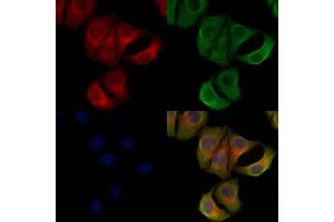ABIN6265268 and ABIN6278321 staining Hela cells by IF/ICC. (SPTBN1 anticorps  (N-Term))