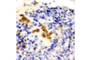 Anti-FLI1 antibody, IHC(P) IHC(P): Rat Spleen Tissue (FLI1 anticorps  (N-Term))