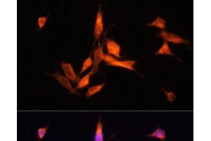 Immunofluorescence analysis of NIH-3T3 cells using MMP10 Polyclonal Antibody at dilution of 1:100 (40x lens). (MMP10 anticorps)