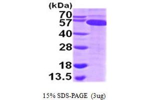 Thioredoxin Reductase 1 (TXNRD1) (AA 161-649) (Active) protein (His tag)