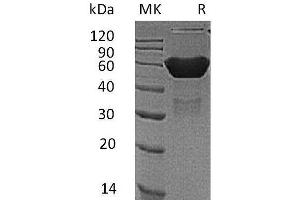 Western Blotting (WB) image for Coxsackie Virus and Adenovirus Receptor (CXADR) protein (Fc Tag) (ABIN7320841)