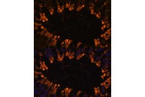 Immunofluorescence analysis of rat testis using OXCT2 antibody (ABIN7265333) at dilution of 1:100. (OXCT2 anticorps  (AA 430-510))