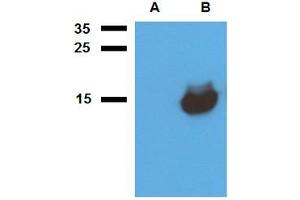 Western blot analysis of polyclonal anti-Mycobacterium tuberculosis antigen Acr1. (HspX anticorps)