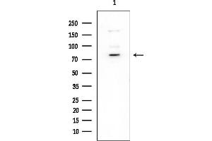 Western blot analysis of lysates from EC304 cells(heat-shock treatment), using Phospho-Tau (Ser202)[Ser519] Antibody at 1/1000 dilution.