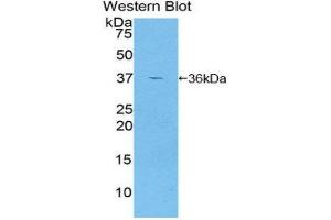 Western Blotting (WB) image for anti-Glutamate Decarboxylase 2 (Pancreatic Islets and Brain, 65kDa) (GAD2) (AA 65-105) antibody (ABIN1858941) (GAD65 anticorps  (AA 65-105))