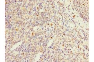 Immunohistochemistry of paraffin-embedded human tonsil tissue using ABIN7174120 at dilution of 1:100 (PTPN7 anticorps  (AA 1-190))
