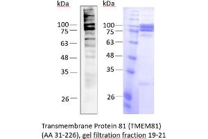 Western Blotting (WB) image for Transmembrane Protein 81 (TMEM81) (AA 31-226) protein (His tag) (ABIN3074693) (TMEM81 Protein (AA 31-226) (His tag))
