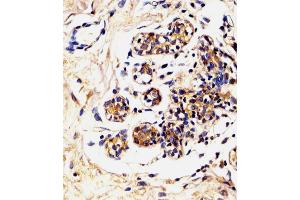 Antibody staining LALBA in Human breast tissue sections by Immunohistochemistry (IHC-P - paraformaldehyde-fixed, paraffin-embedded sections). (LALBA anticorps  (AA 39-68))