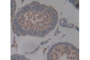 IHC-P analysis of Human Tissue, with DAB staining. (DNAH11 anticorps  (AA 17-299))