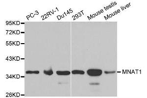 Western blot analysis of extracts of various cell lines, using MNAT1 antibody. (MNAT1 anticorps  (AA 1-309))