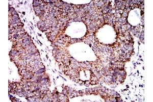 Immunohistochemistry (IHC) image for anti-Superoxide Dismutase 2, Mitochondrial (SOD2) (AA 1-222) antibody (ABIN5888812) (SOD2 anticorps  (AA 1-222))