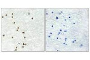 Immunohistochemistry analysis of paraffin-embedded human brain tissue using ZIC1/2/3 antibody. (ZIC1 anticorps)
