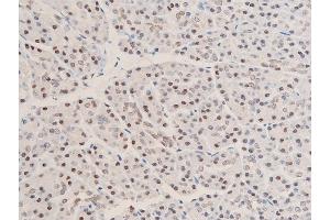 ABIN6267073 at 1/100 staining human duodenum tissue sections by IHC-P.