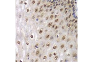 Immunohistochemistry of paraffin-embedded human esophagus using DDX5 antibody.