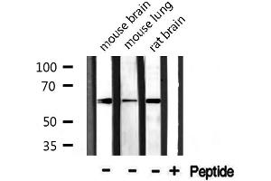 Western blot analysis of extracts from various tissue, using CDKAL antibody. (CDKAL1 anticorps  (N-Term))