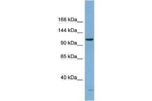 WB Suggested Anti-DHX15 Antibody Titration:  0. (DHX15 anticorps  (N-Term))