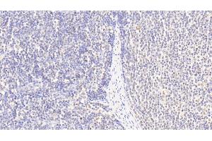 Detection of HIST2H3A in Human Lymph node Tissue using Polyclonal Antibody to Histone Cluster 2, H3a (HIST2H3A) (HIST2H3A anticorps  (AA 1-136))