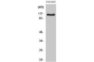 Western Blotting (WB) image for anti-RhoGEF p115 (Internal Region) antibody (ABIN3177221) (RhoGEF p115 (Internal Region) anticorps)