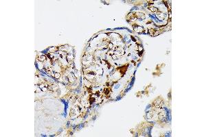 Immunohistochemistry of paraffin-embedded human placenta using Fibrinogen alpha chain (FGA) (FGA) Rabbit mAb (ABIN7267177) at dilution of 1:100 (40x lens).
