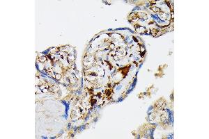 Immunohistochemistry of paraffin-embedded human placenta using Fibrinogen alpha chain (FGA) (FGA) Rabbit mAb (ABIN7267177) at dilution of 1:100 (40x lens). (FGA anticorps)