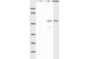 Lane 1: mouse brain lysates Lane 2: mouse lung lysates probed with Anti Phospho-Lyn (Tyr507) Polyclonal Antibody, Unconjugated (ABIN743603) at 1:200 in 4 °C.