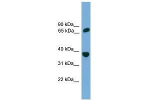 WB Suggested Anti-POT1 Antibody Titration: 0. (POT1 anticorps  (Middle Region))