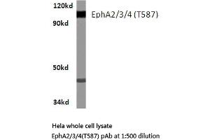 Western blot (WB) analysis of EphA2/3/4 antibody in extracts from Hela cells. (EPH Receptor A2 anticorps)