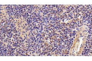 Detection of GSN in Porcine Spleen Tissue using Polyclonal Antibody to Gelsolin (GSN)