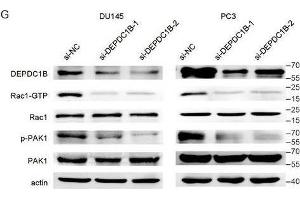 DEPDC1B regulates the Rho signaling pathway and binds to Rac1.