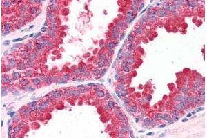 Human Prostate (formalin-fixed, paraffin-embedded) stained with DUSP1 antibody ABIN351458 at 3. (DUSP1 anticorps  (AA 355-367))