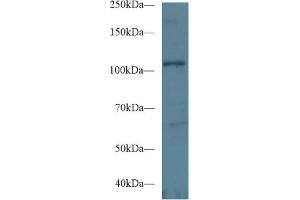 Western Blot; Sample: Human Hela cell lysate; Primary Ab: 1µg/ml Rabbit Anti-Mouse EPHA1 Antibody Second Ab: 0.