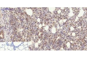 Immunohistochemistry of paraffin-embedded Rat lung tissue using YAP1 Polyclonal Antibody at dilution of 1:200. (YAP1 anticorps)