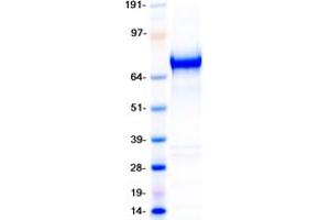 Validation with Western Blot