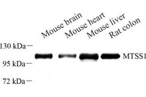 Western blot analysis of MTSS1 (ABIN7074604) at dilution of 1: 500 (MTSS1 anticorps)