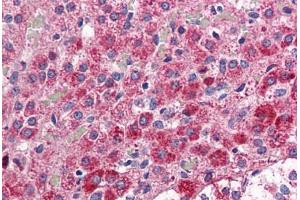 Adrenal, Human: Formalin-Fixed, Paraffin-Embedded (FFPE)