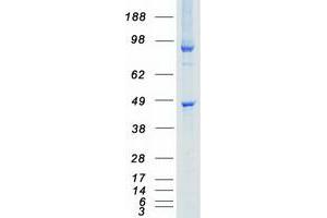 Validation with Western Blot