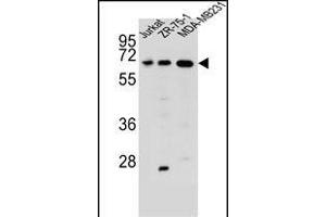 ZSCAN2 Antibody (N-term) (ABIN657010 and ABIN2846190) western blot analysis in Jurkat,ZR-75-1,MDA-M cell line lysates (35 μg/lane). (ZSCAN2 anticorps  (N-Term))