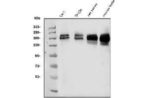 Western blot analysis of KDM5B using anti-KDM5B antibody (ABIN4886648). (KDM5B anticorps  (Middle Region))