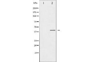 Western blot analysis of CCR5 phosphorylation expression in Jurkat whole cell lysates,The lane on the left is treated with the antigen-specific peptide. (CCR5 anticorps  (pSer336))