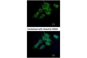 ICC/IF Image Immunofluorescence analysis of methanol-fixed Hep3B, using HSD17B4, antibody at 1:500 dilution. (HSD17B4 anticorps)