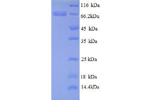 SDS-PAGE (SDS) image for Hydroxyacid Oxidase (Glycolate Oxidase) 1 (HAO1) (AA 23-604), (partial) protein (His tag) (ABIN5710758)