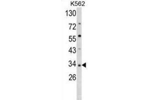 Western Blotting (WB) image for anti-Secreted Frizzled-Related Protein 5 (SFRP5) antibody (ABIN3002916)