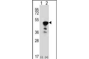 Western blot analysis of FEN1 (arrow) using rabbit polyclonal FEN1 Antibody (Center) (ABIN389376 and ABIN2839472). (FEN1 anticorps  (AA 243-272))