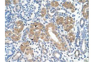 Image no. 1 for anti-Fumarylacetoacetate Hydrolase (Fumarylacetoacetase) (FAH) (AA 311-360) antibody (ABIN320667)