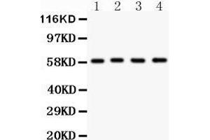 Anti- G6PD antibody, Western blotting All lanes: Anti G6PD  at 0. (Glucose-6-Phosphate Dehydrogenase anticorps  (AA 315-515))