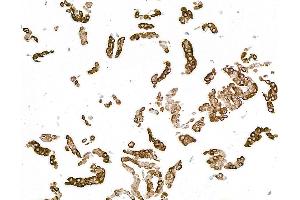 Immunocytochemistry (ICC) image for anti-Keratin 14 (KRT14) (C-Term) antibody (ABIN7795697) (Recombinant KRT14 anticorps  (C-Term))