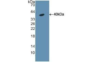 Detection of Recombinant KRT18, Rat using Polyclonal Antibody to Cytokeratin 18 (CK18)