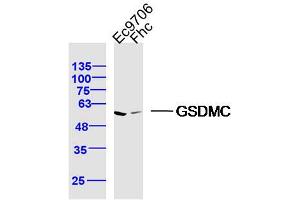 Lane 1: Ec9706 lysates Lane 2: FHC lysates probed with GSDMC Polyclonal Antibody, Unconjugated  at 1:300 dilution and 4˚C overnight incubation. (MLZE anticorps  (AA 1-100))