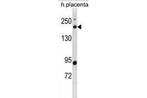 BCL9L Antibody (N-term) (ABIN1881110 and ABIN2838843) western blot analysis in human placenta tissue lysates (35 μg/lane). (BCL9L anticorps  (N-Term))